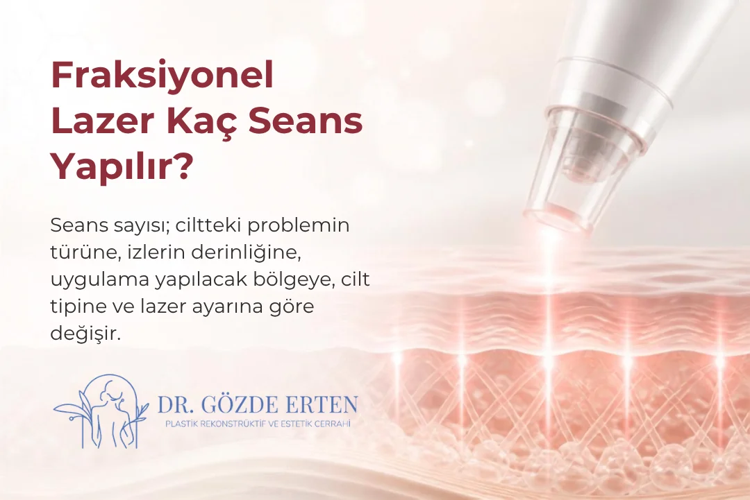 Fraksiyonel lazer kaç seans yapılır?