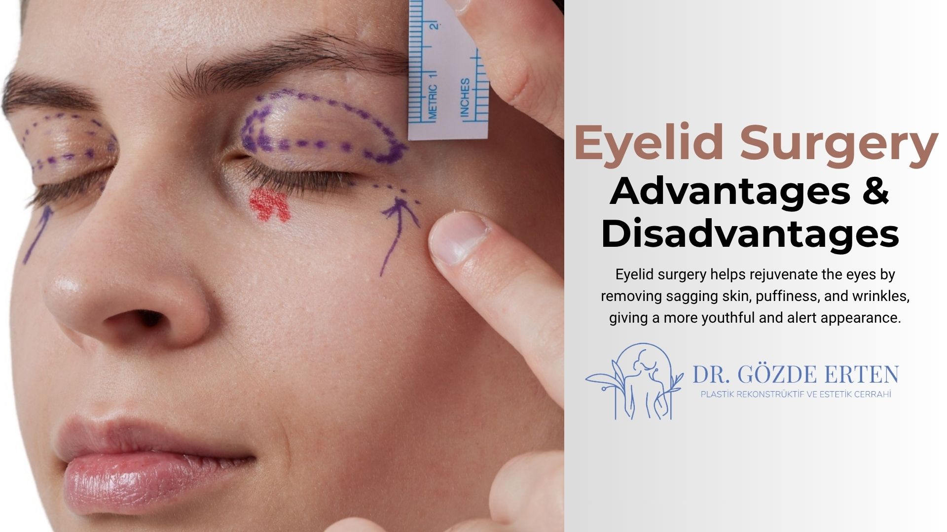 Advantages and Disadvantages of Eyelid Surgery Advantages and Disadvantages of Eyelid Surgery