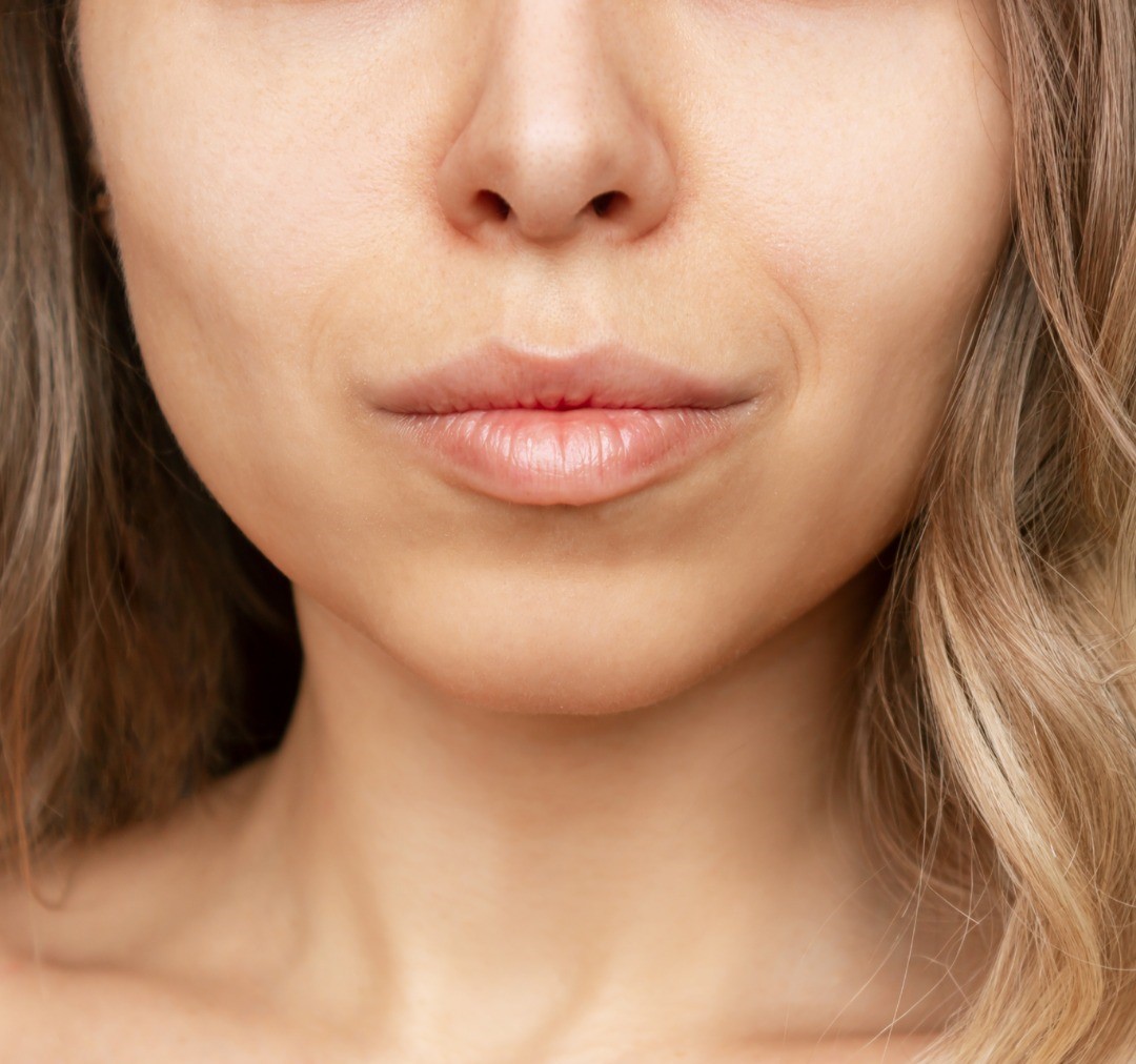 Buccal Fat Removal Before & After Procedure Buccal Fat Removal Before & After Procedure
