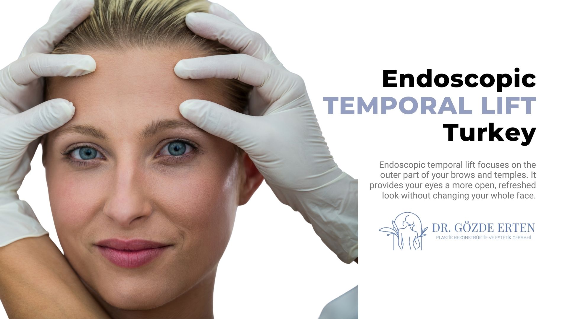 Endoscopic Temporal Lift Endoscopic Temporal Lift