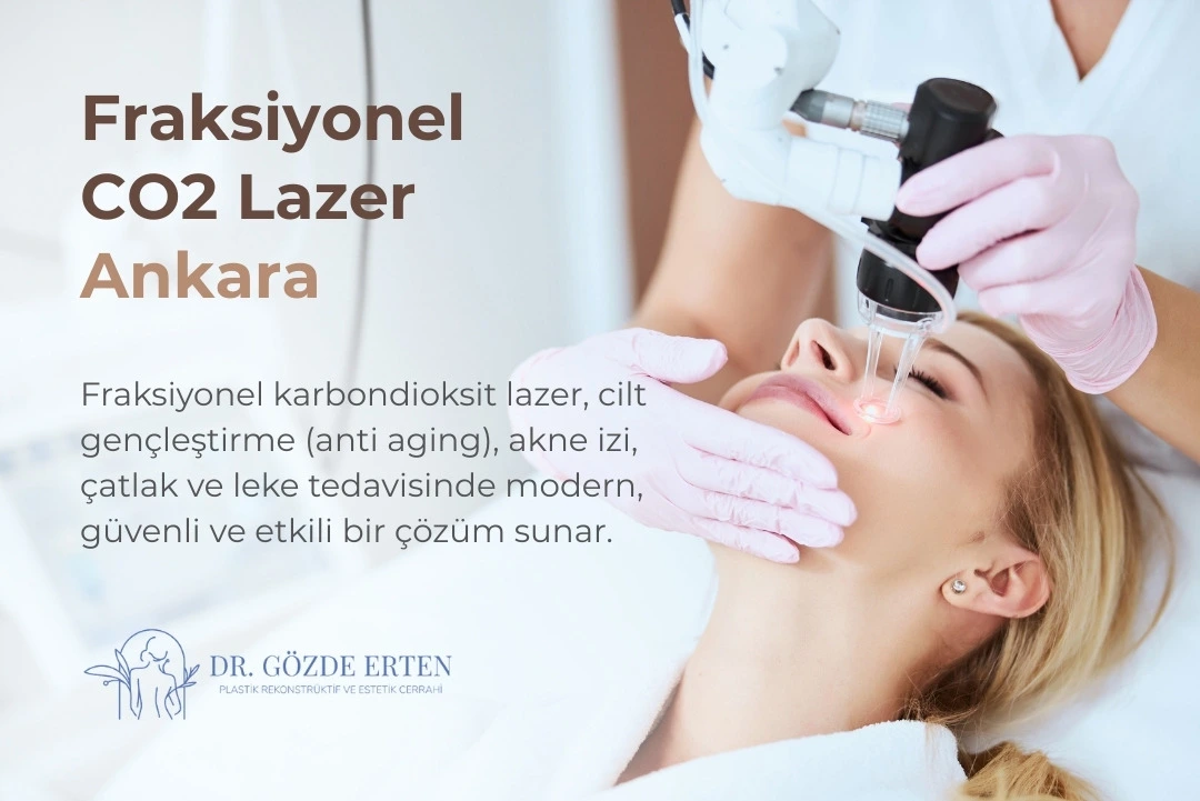 Fraksiyonel Lazer Ankara, Karbondioksit (CO2) Lazer, Fiyatları