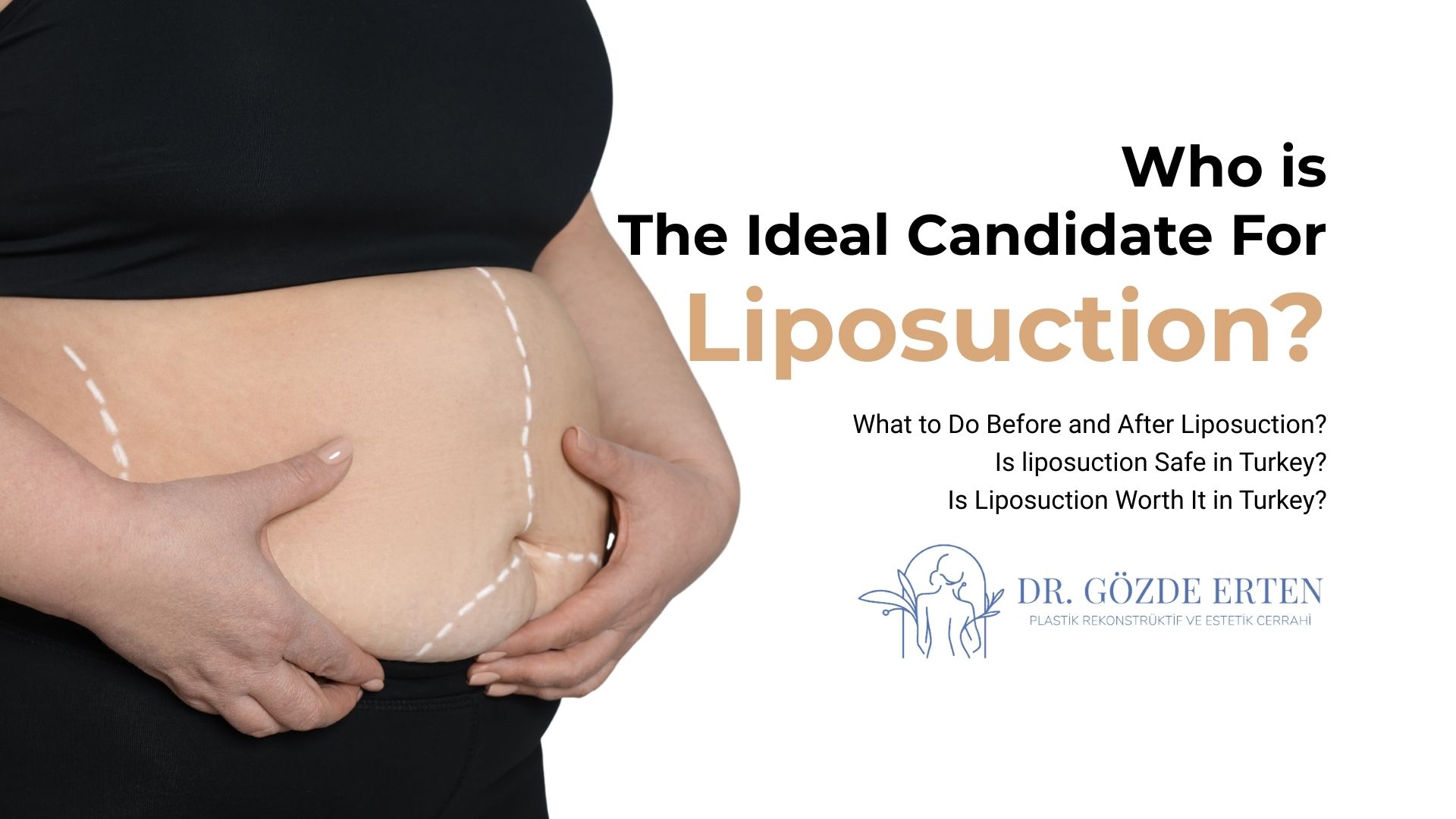 Who is the ideal candidate for liposuction? Endoscopic Temporal Lift