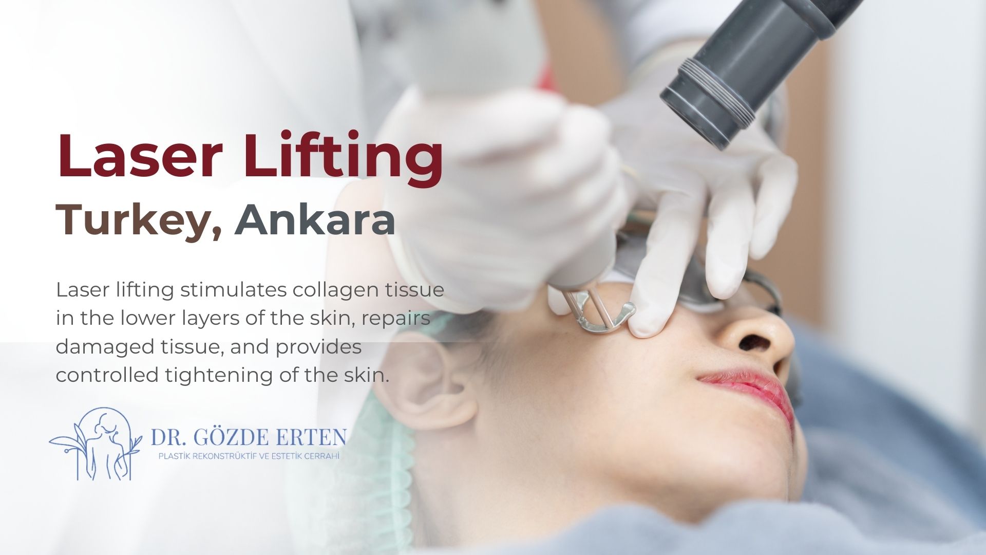 Laser Lifting in Turkey, Ankara