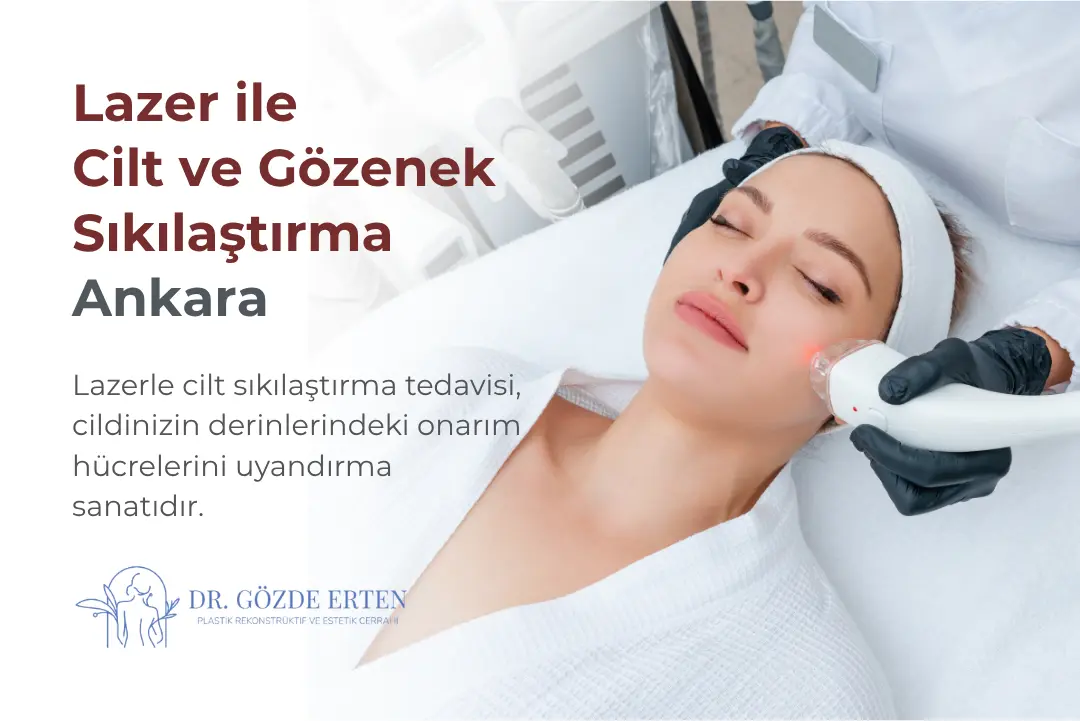 Lazer ile Cilt Sıkılaştırma ve Gözenek Tedavisi Ankara
