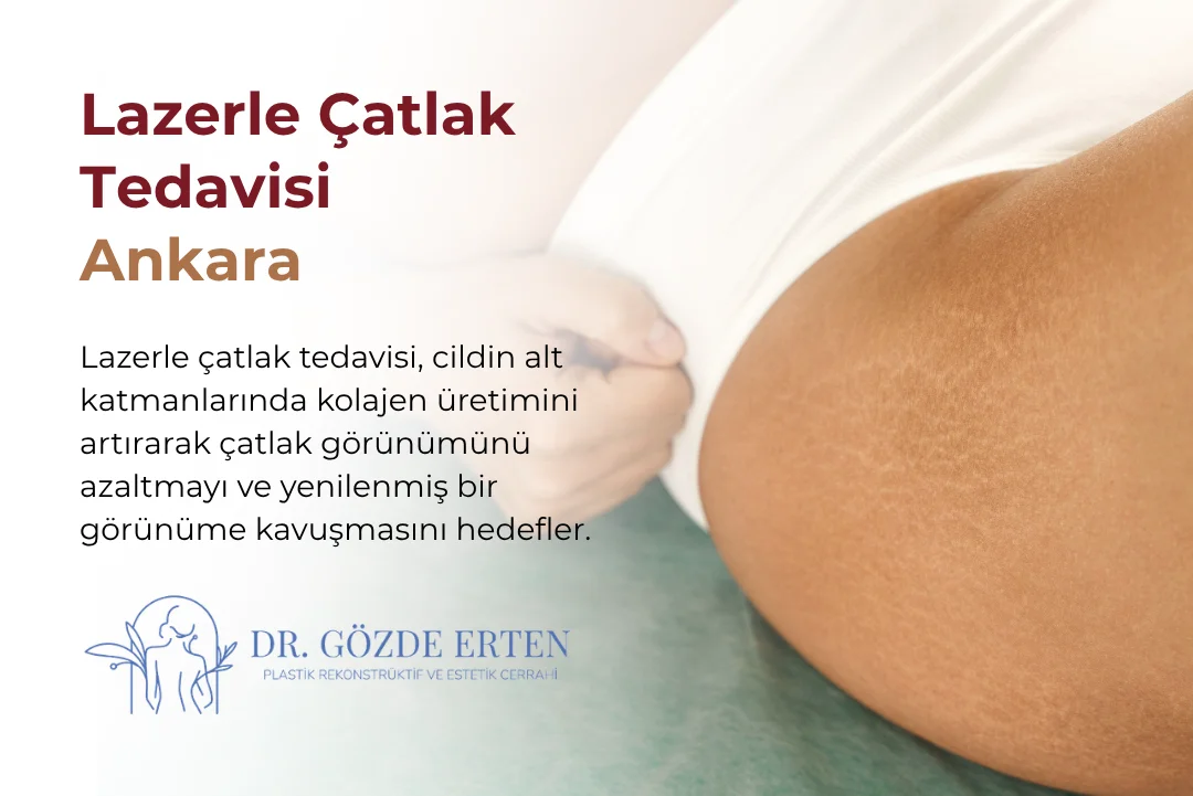 Ankara'da lazerle çatlak tedavisi uygulaması ve fiyatları, Op. Dr. Gözde Erten