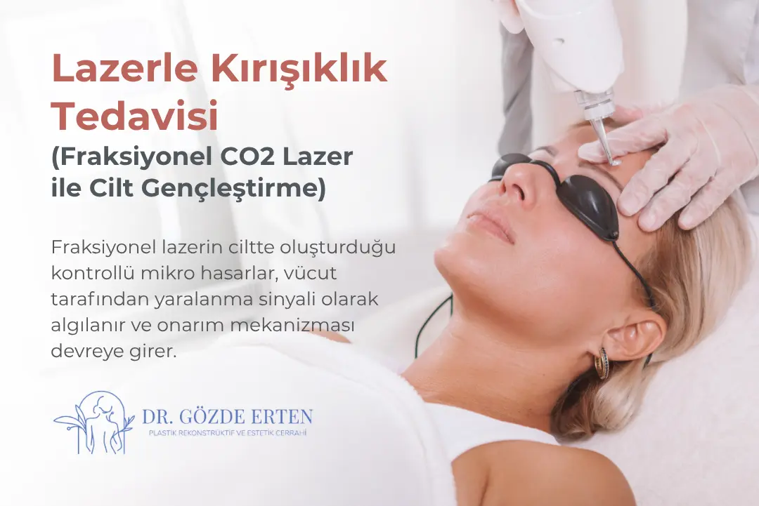 Lazerle Kırışıklık Tedavisi Ankara, Fraksiyonel CO2 Lazer ile Cilt Gençleştirme ve Fiyatları