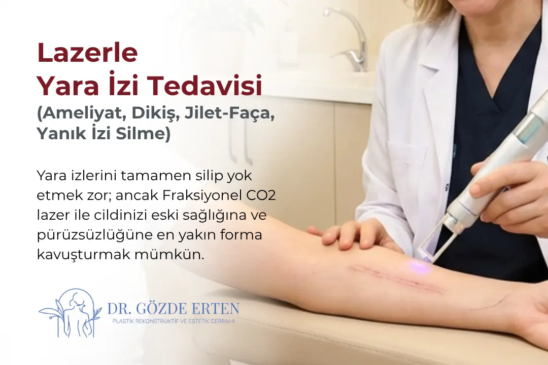 Lazerle Yara İzi Tedavisi Ankara, Lazerle Ameliyat, Dikiş, Jilet (Faça), Yanık İzi Silme ve Fiyatları | Op. Dr. Gözde Erten
