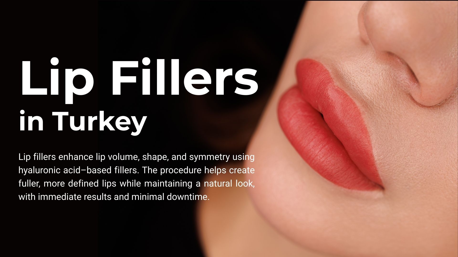 lip-filler-turkey