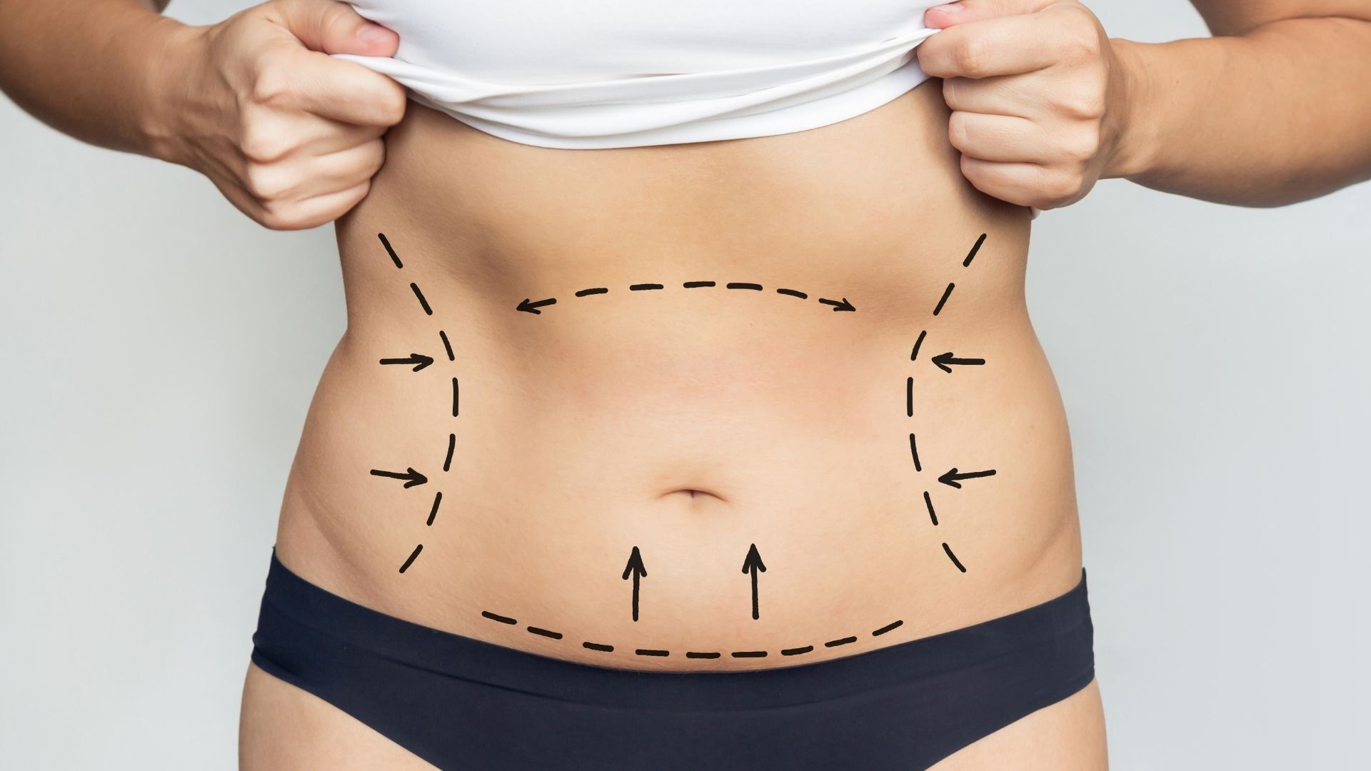 liposuction-safe-in-turkey liposuction-safe-in-turkey